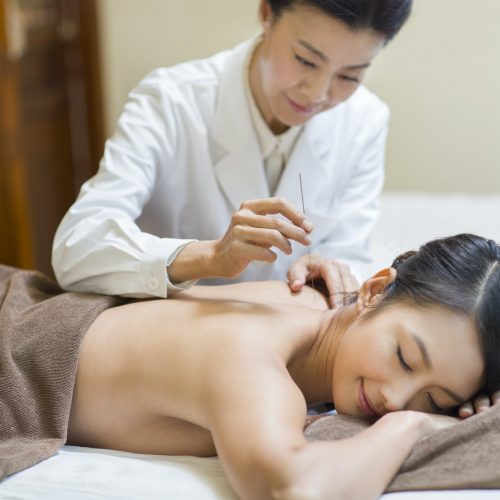 Young woman receiving acupuncture